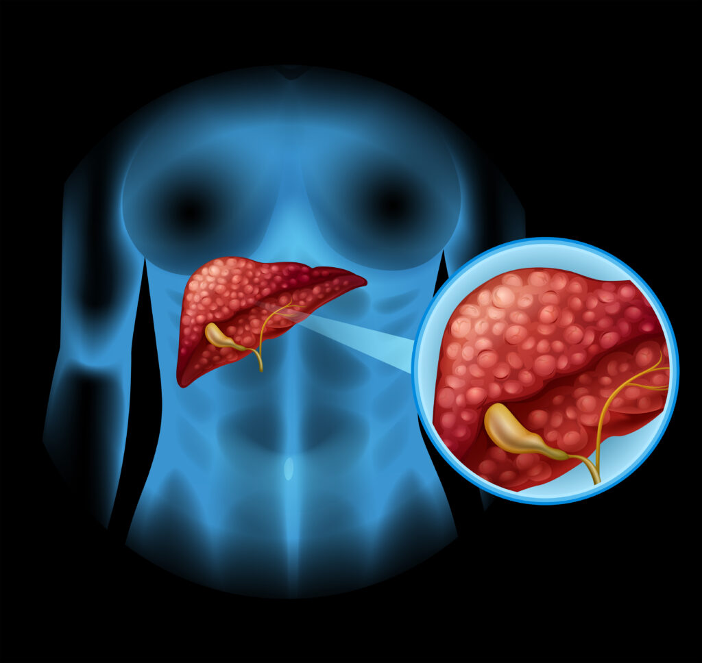 Pancreas